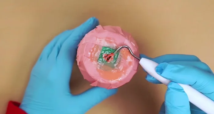 Scrub the design with a blue Scotch-Brite pad to remove the loosened powder coating. Rinse and let dry.